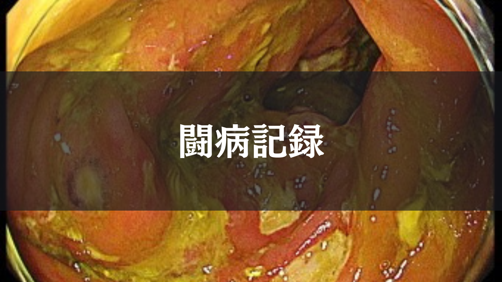 闘病記録